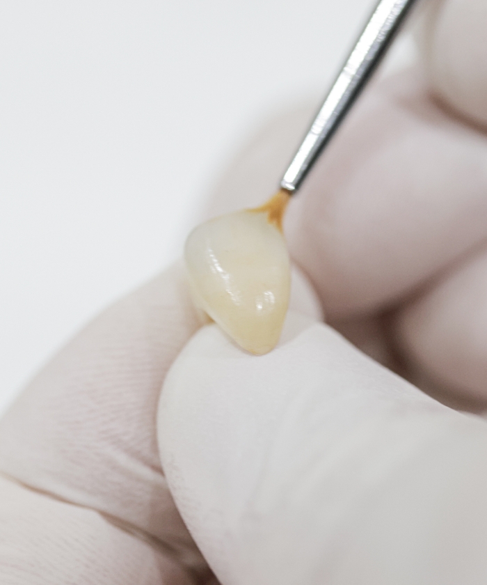 審美性高いセラミック治療とインプラントをご提供します