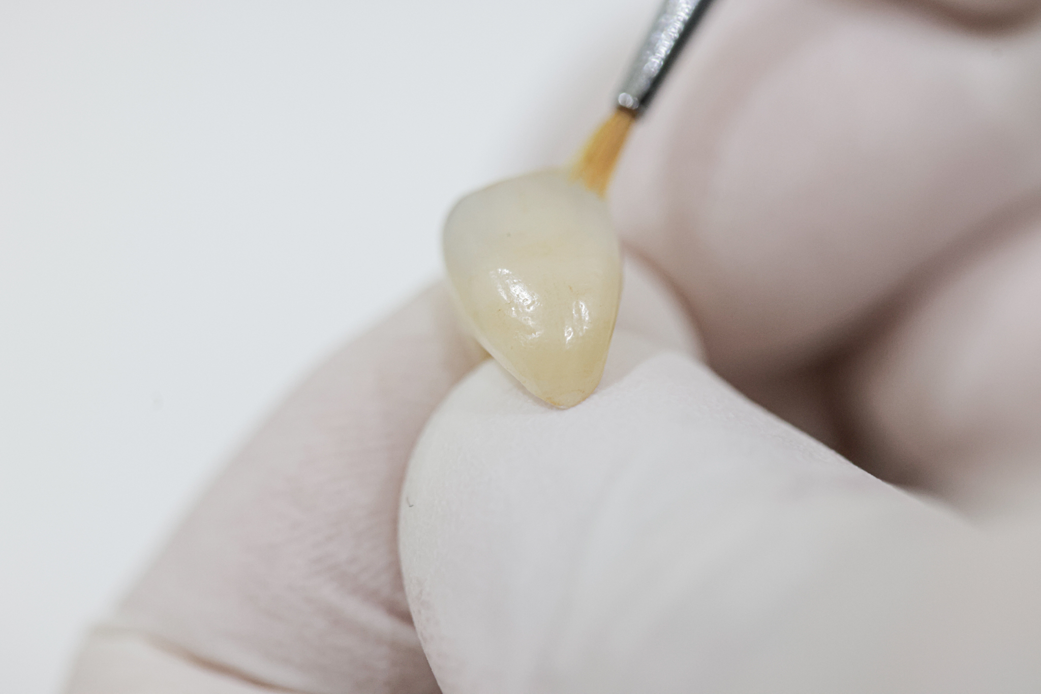  かぶせ物の装着