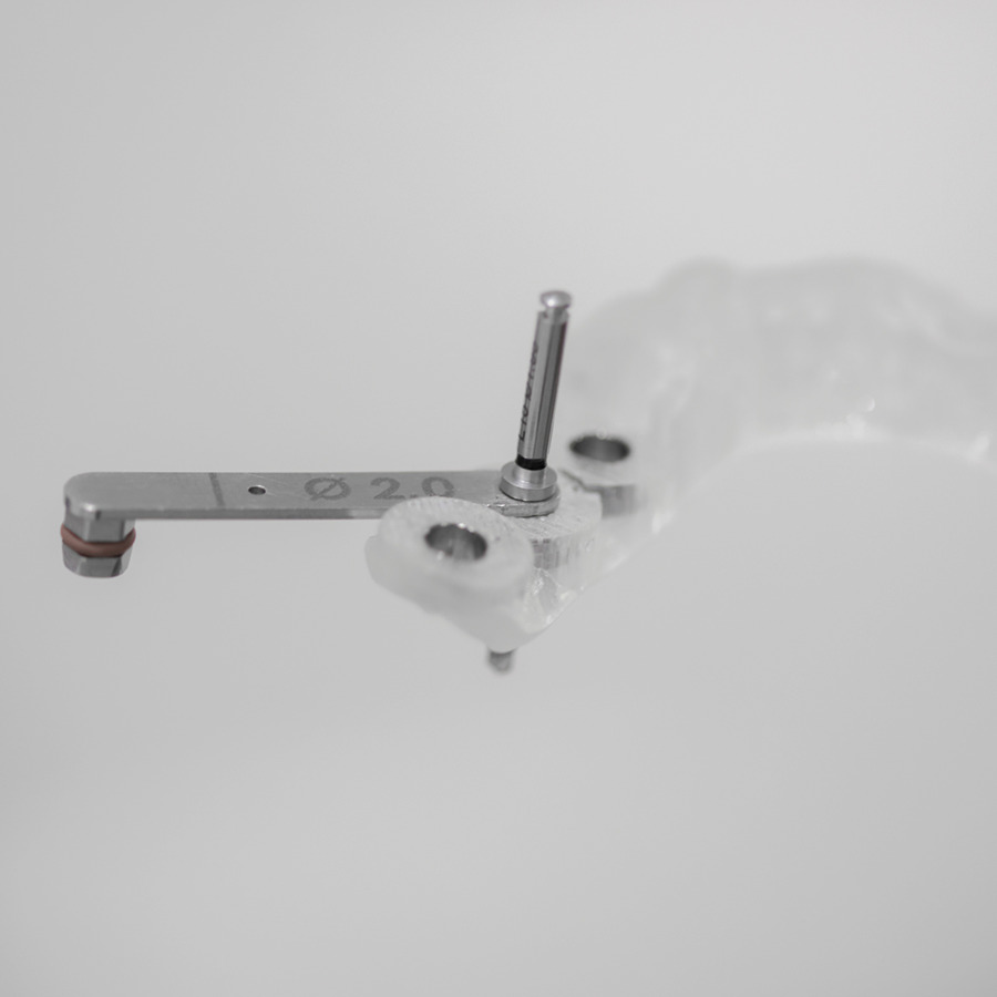 精密インプラント精密義歯（入れ歯）