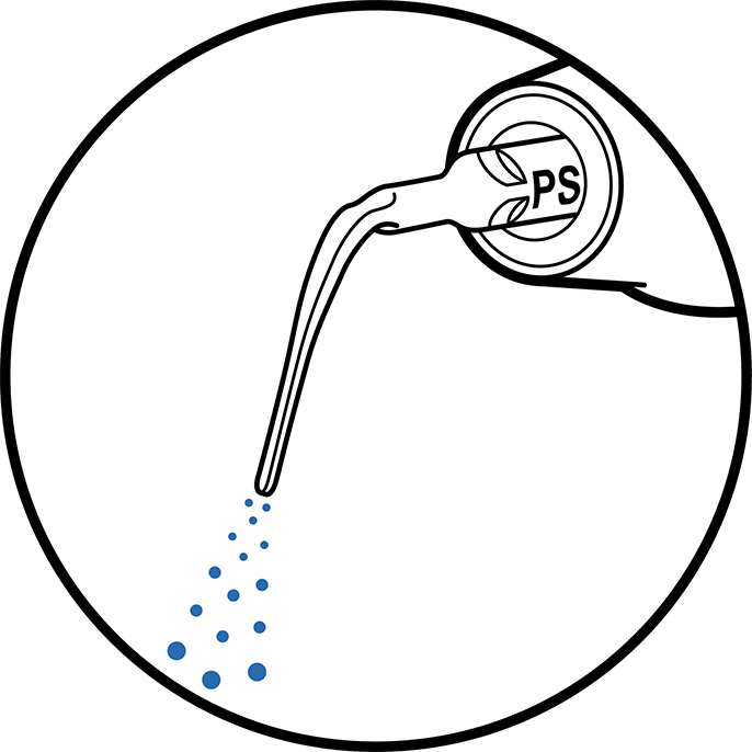 スマートピエゾンによる歯石除去